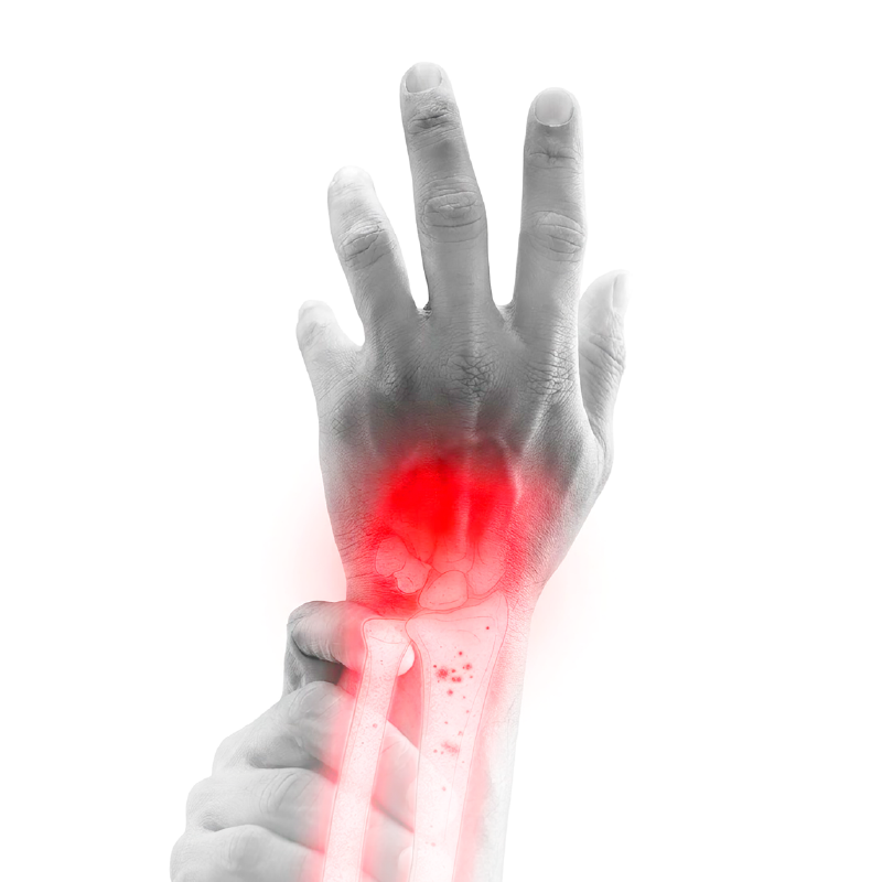 Resonancia magnética de muñeca y mano especializada