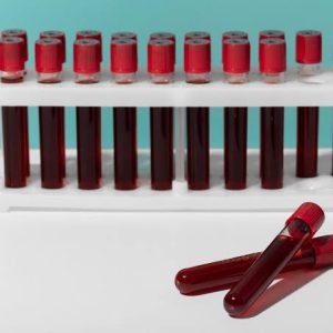 Química Sanguínea de 6 elementos